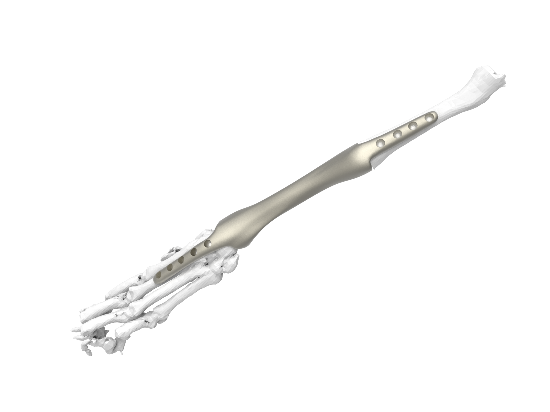 Veterinary implant type 3